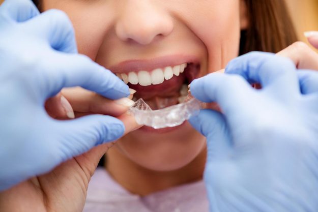 How Orthodontics can transform your Smile